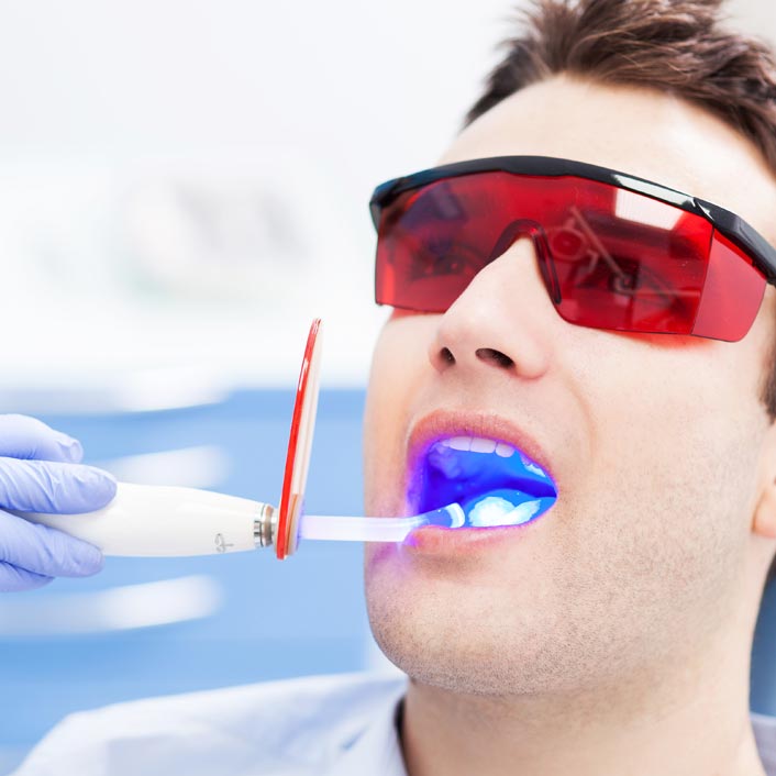 Cavity Detecting Laser - Dental Technology